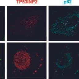 tratamientos contra el cáncer