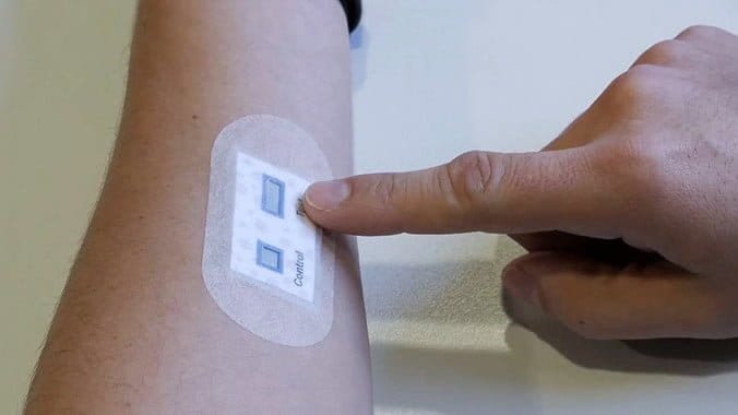 Un-nuevo-parche-para-la-piel-facilita-el-diagnostico-de-la-fibrosis-quistica